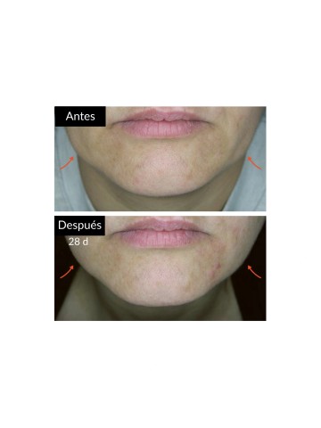 Meso Serum - DMAE-Lift serum 30ml.